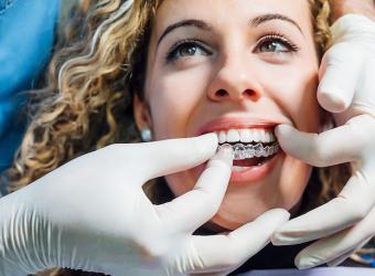 How to get the most out of Invisalign®